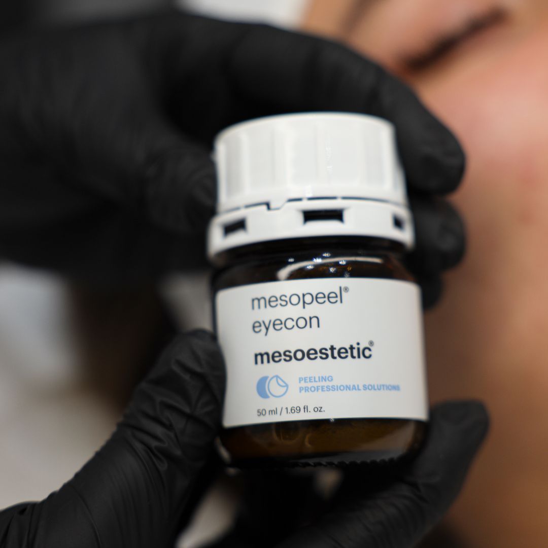 Chemische peeling huidvernieuwing mesopeel - mesoestetic - Rotterdam