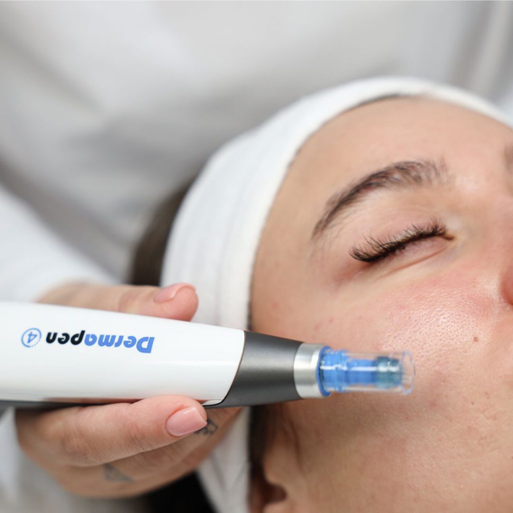 Dermapen 4 microneedling - gezichtsbehandeling