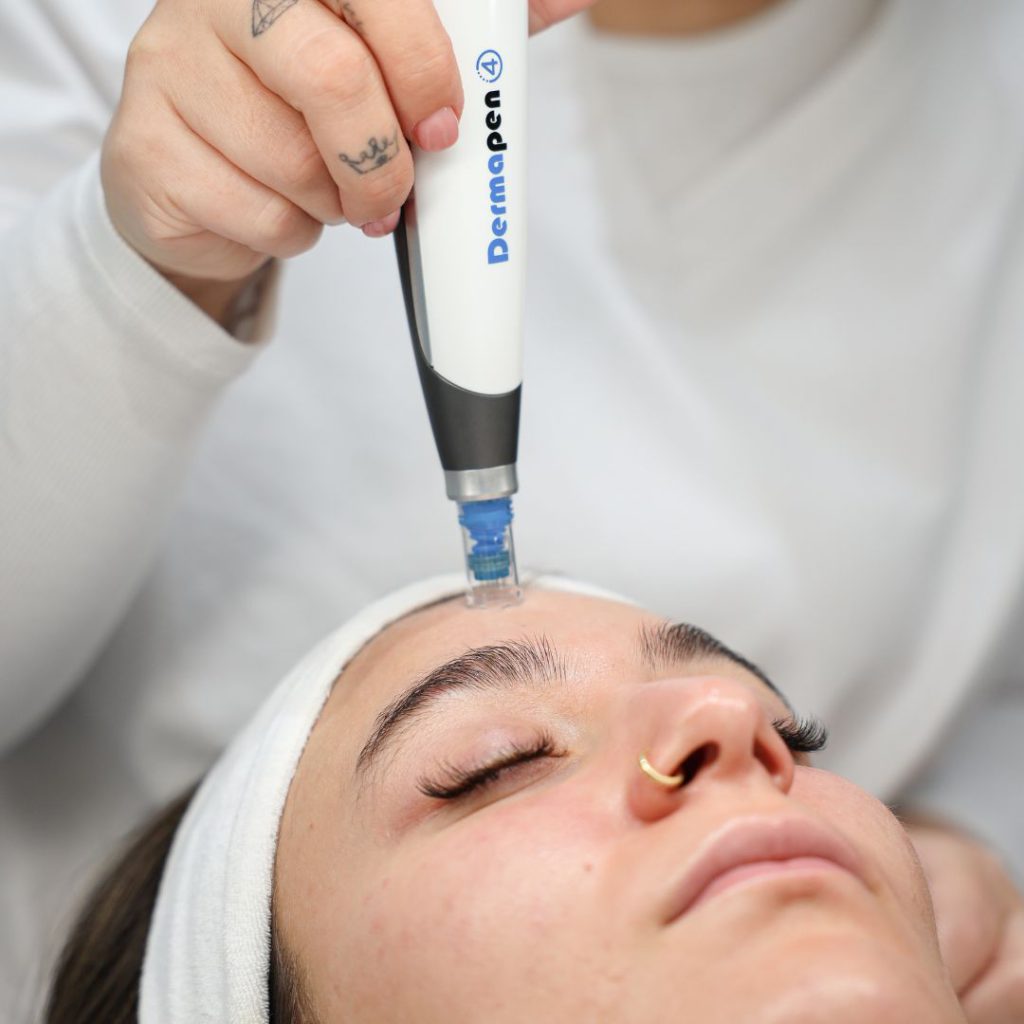 Dermapen 4 microneedling - gezichtsbehandeling